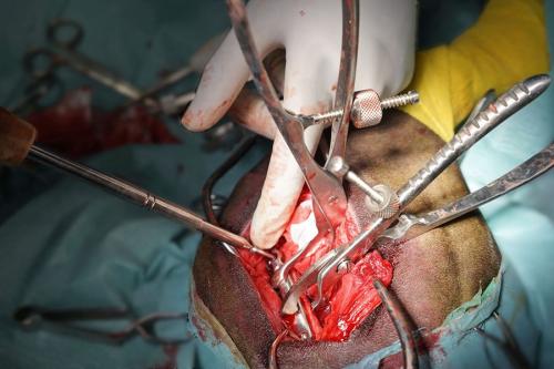 traumatologia_cirugia